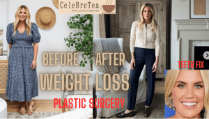 Shea Mcgee Weight Loss, Plastic Surgery & Teeth 100% Facts!