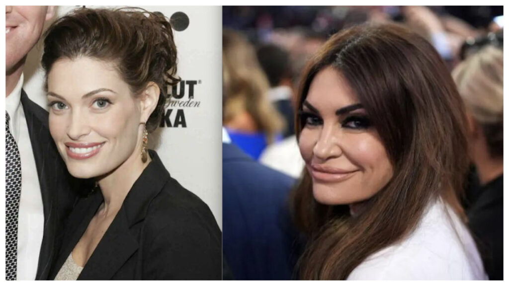 Kimberly Guilfoyle Before And After celebretea.com 