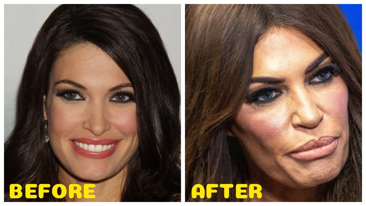 Kimberly Guilfoyle: Addressing Plastic Surgery Rumors and Public Appearance