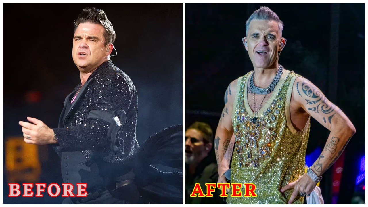 Robbie Williams’ Weight-Loss Jabs Fear: Vision Issues & His 2025 Comeback