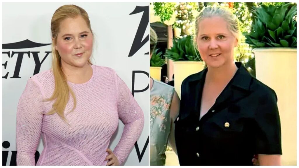 Amy Schumer in May 2024 vs. Amy Schumer in October 2025 celebretea.com
