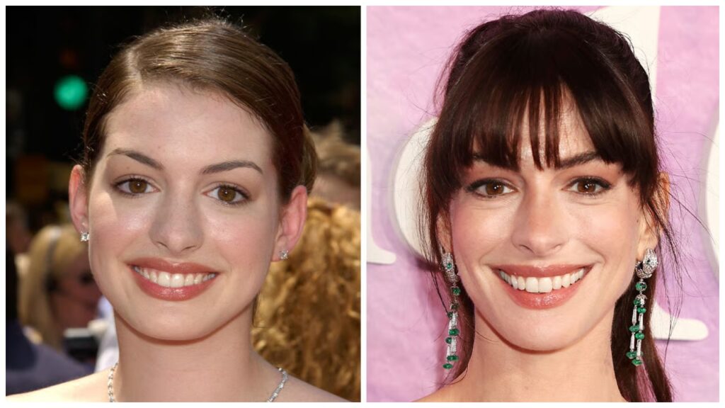 Anne Hathaway: Then (2001) vs. Now (Recent Years) celebretea.com