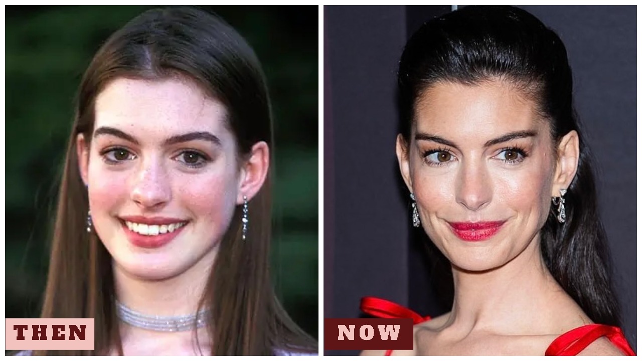 Anne Hathaway at 43: Plastic Surgery Rumors, Before & After, Movies & Net Worth in 2025