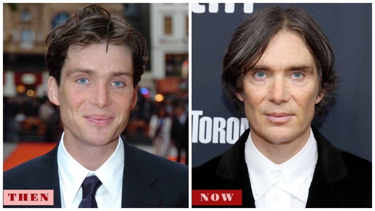 Cillian Murphy Plastic Surgery 2025: Age, Net Worth, Movies & Family