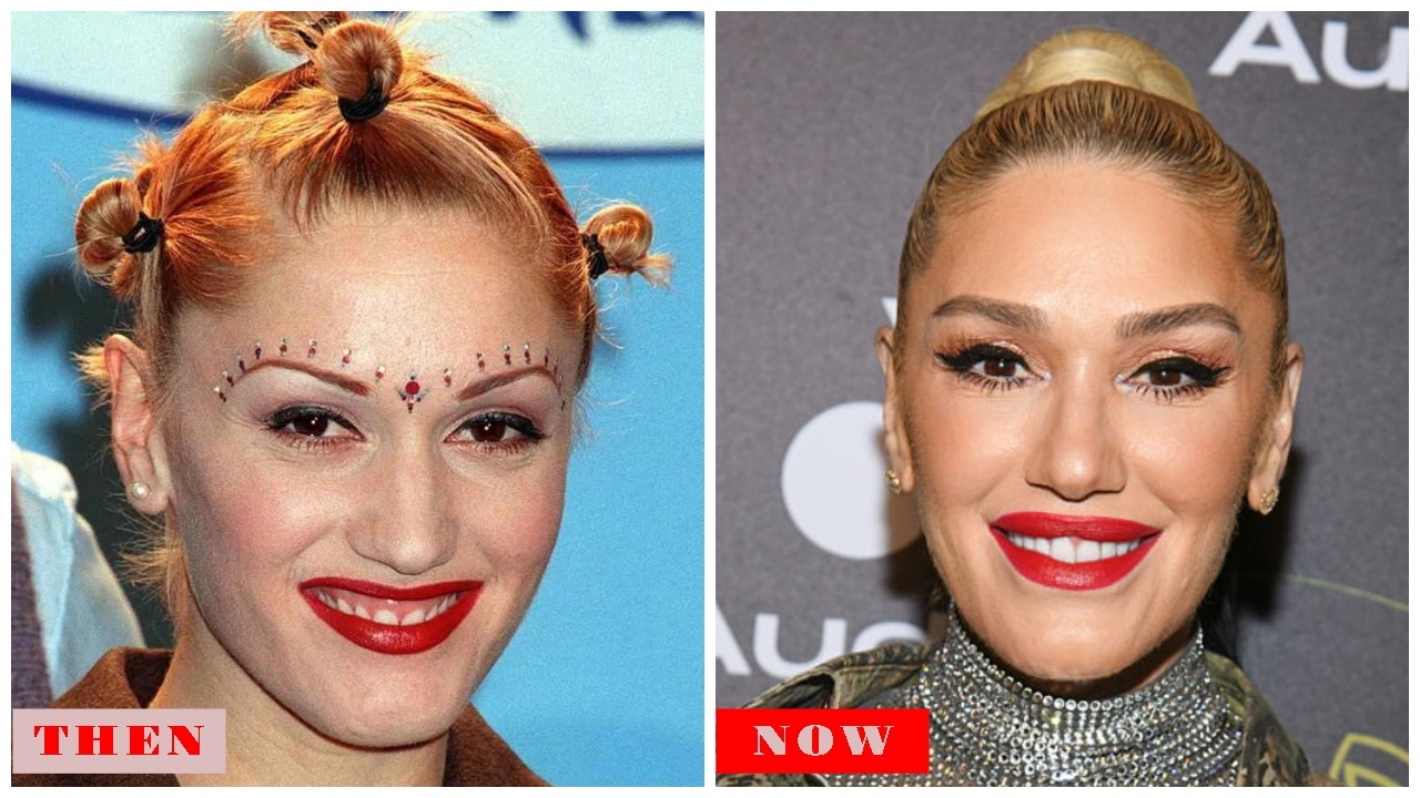 Gwen Stefani in 2025: Plastic Surgery Rumors, Net Worth, Age, Blake Shelton & Career Highlights
