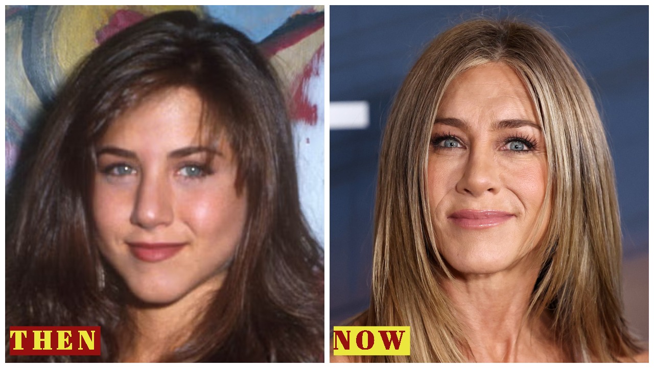 Jennifer Aniston 2025: Plastic Surgery Rumors, Net Worth, New Boyfriend & Age-Defying Transformation