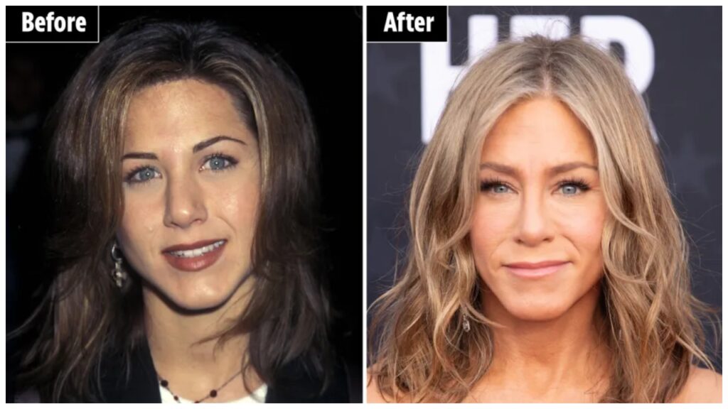 Jennifer Aniston in 1995 vs. Jennifer Aniston now celebretea.com