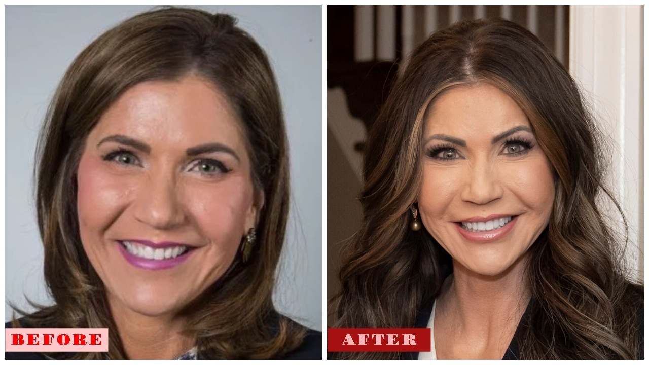 Kristi Noem 2025: Plastic Surgery Rumors, Net Worth, Husband, Age, and DHS Controversies