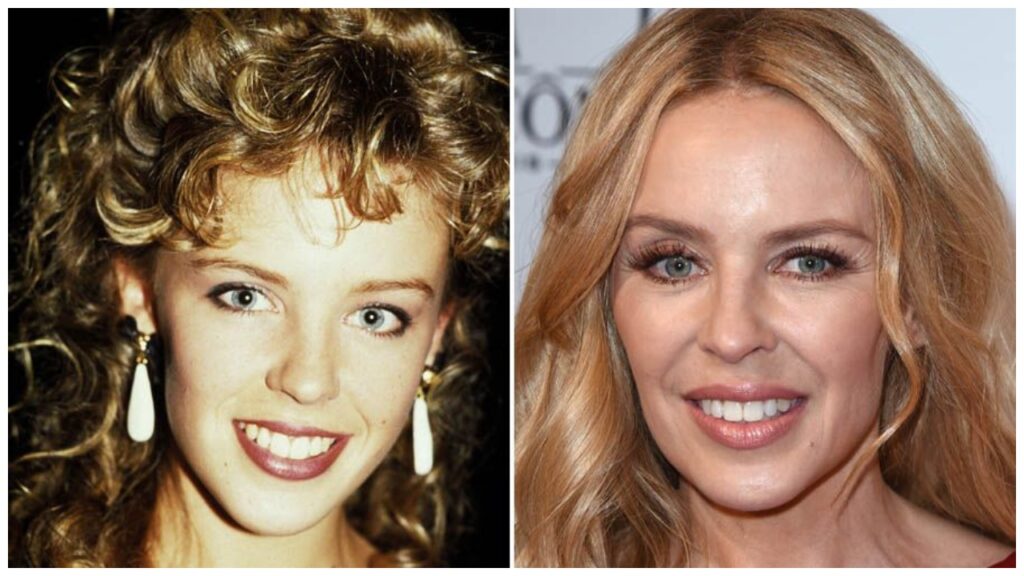 Kylie Minogue Then vs. Now 2025 celebretea.com