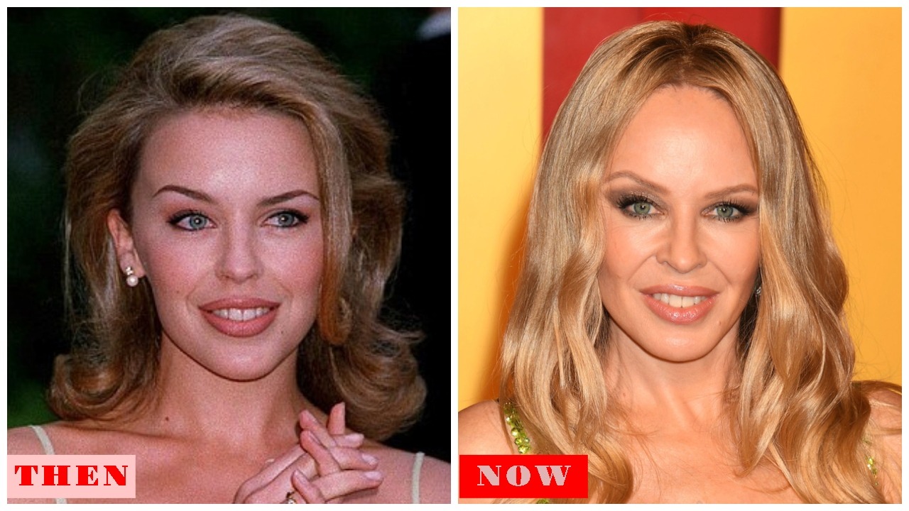 Kylie Minogue in 2025: Age, Net Worth, Songs, Breast Cancer Journey & Plastic Surgery Rumors