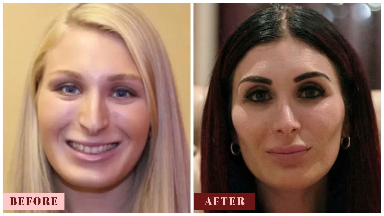 Laura Loomer 2025: Plastic Surgery Rumors, Trump Influence, Net Worth & Controversial Rise celebretea.com