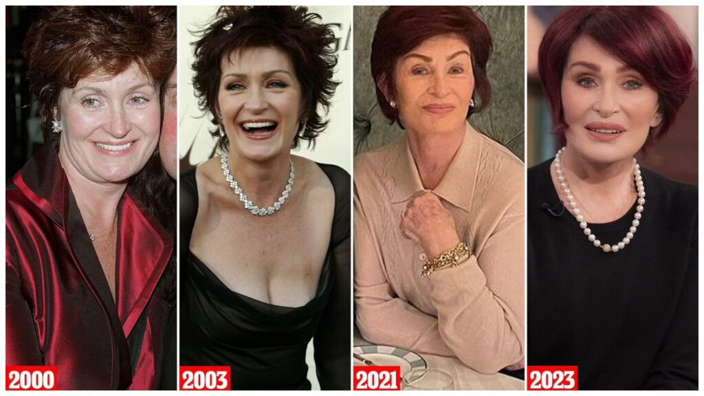 Sharon Osbourne has admitted to more than a dozen cosmetic procedures celebretea.com