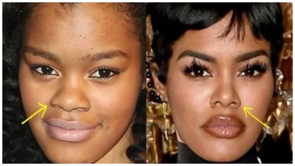 Teyana Taylor Then vs. Now celebretea.com