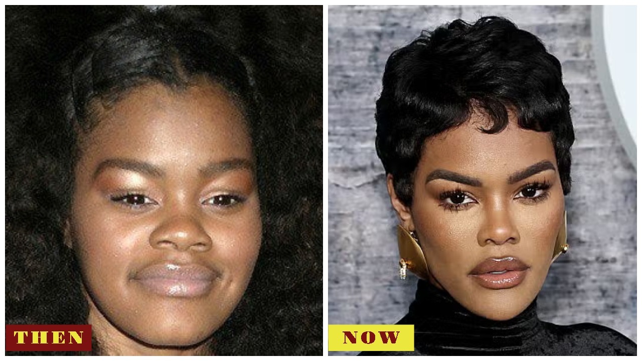 Teyana Taylor Then and Now in 2025: Net Worth, Boyfriend, Divorce & Plastic Surgery Talk